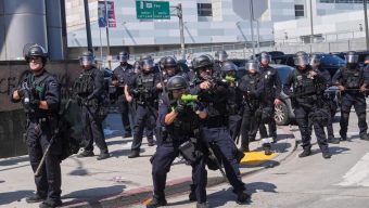 Man sues, says jaw was shattered when police shot him with a foam projectile during LA immigration demonstration